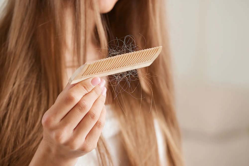 علل پنهان و روش‌های درمانی ریزش موی هورمونی و استرسی