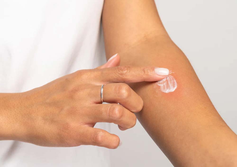 چگونه محصولات جدید را "پچ تست" کنیم تا از حساسیت جلوگیری شود؟